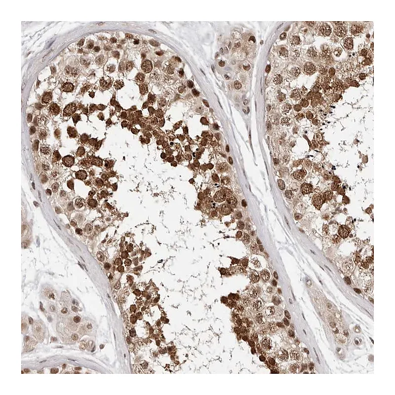 Atlas Antibodies Anti-SDE2 Antibody