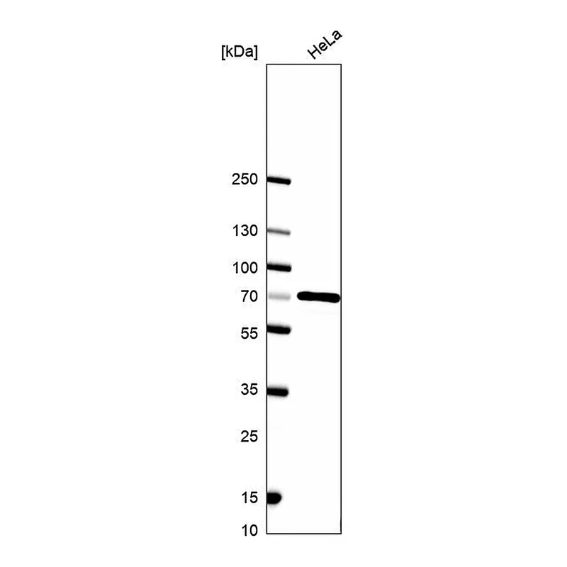 Atlas Antibodies Anti-SDHA Antibody