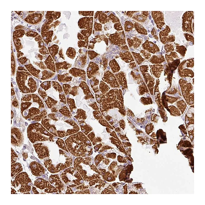 Atlas Antibodies Anti-SDHA Antibody