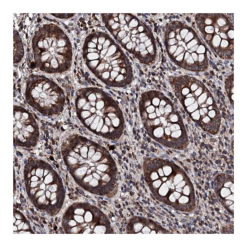 Atlas Antibodies Anti-SDHAF2 Antibody