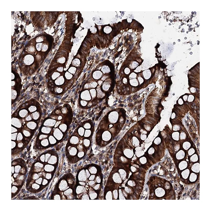 Atlas Antibodies Anti-SDHAF2 Antibody
