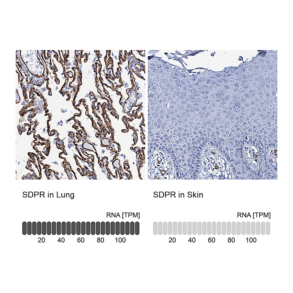 Atlas Antibodies Anti-SDPR Antibody