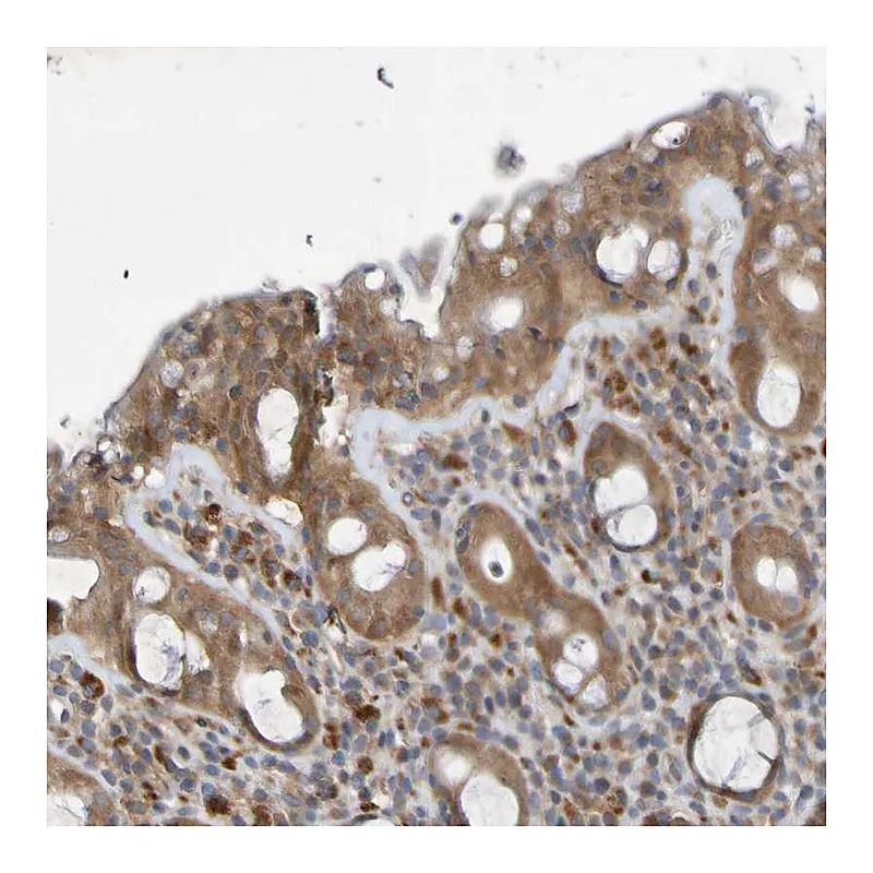 Atlas Antibodies Anti-SDK1 Antibody