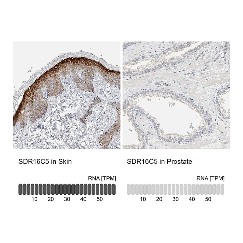 Atlas Antibodies Anti-SDR16C5 Antibody