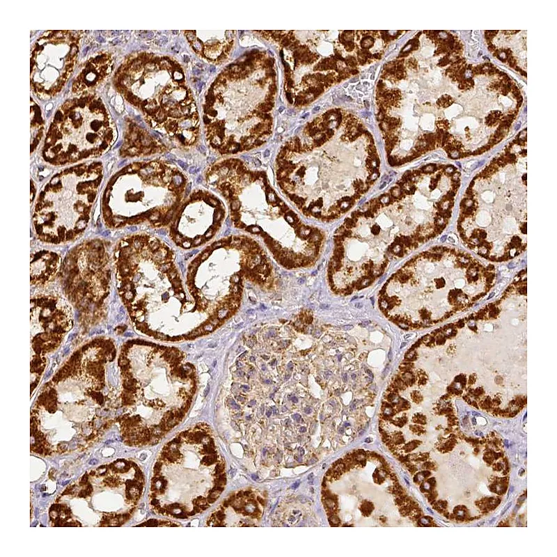 Atlas Antibodies Anti-SDHB Antibody