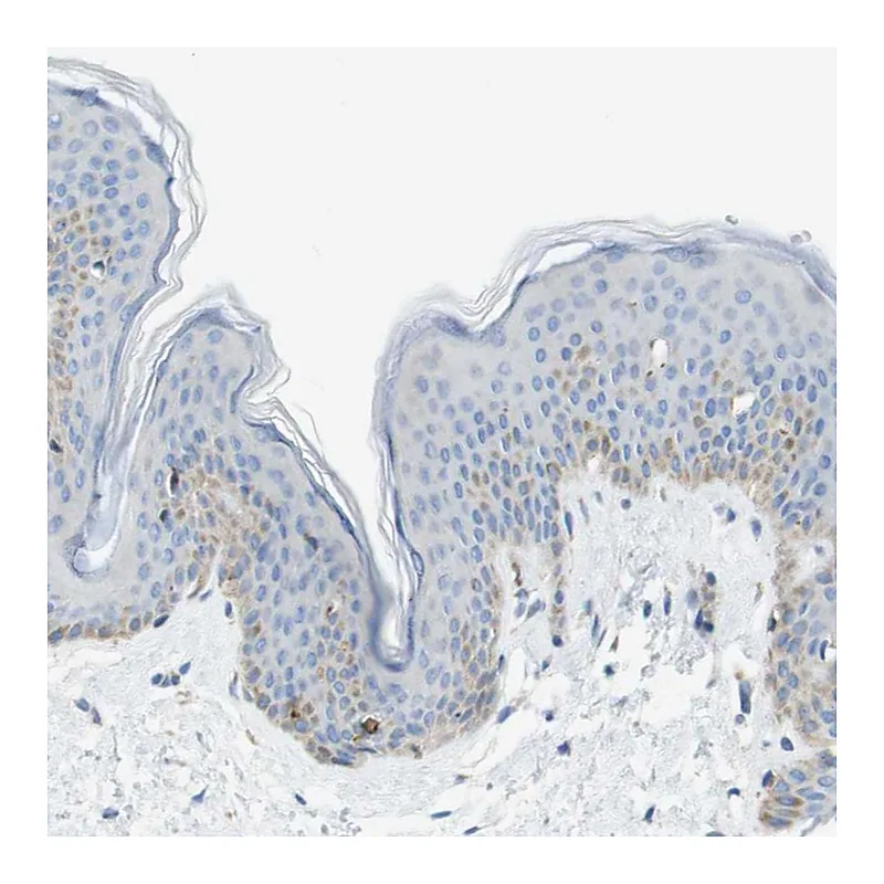 Atlas Antibodies Anti-SDR42E1 Antibody