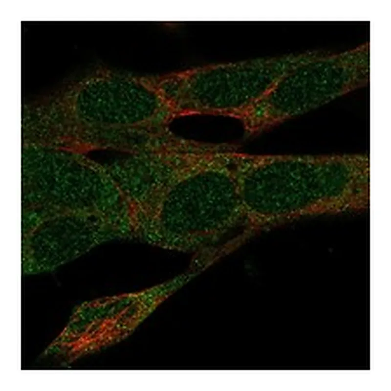 Atlas Antibodies Anti-SDR39U1 Antibody