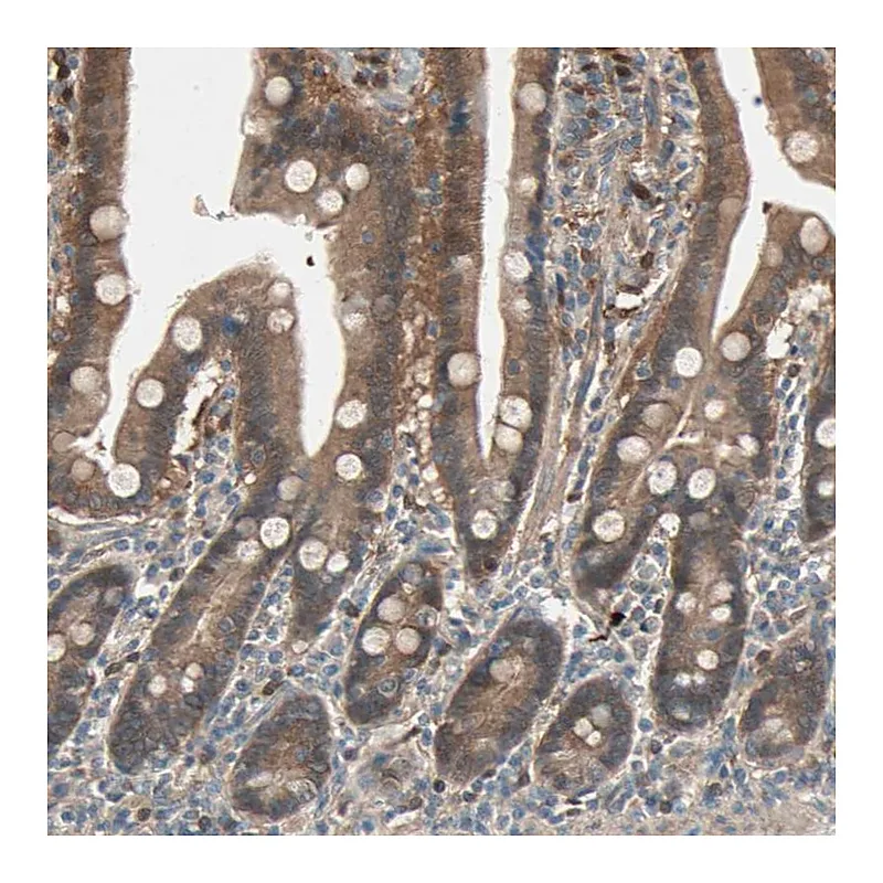 Atlas Antibodies Anti-SDSL Antibody
