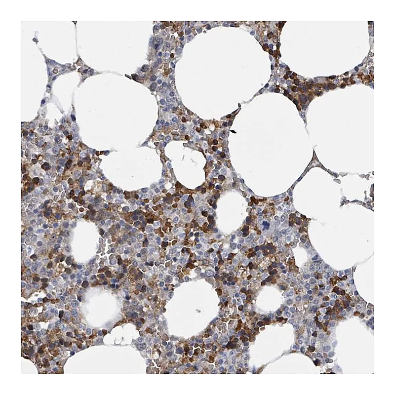Atlas Antibodies Anti-SEBOX Antibody