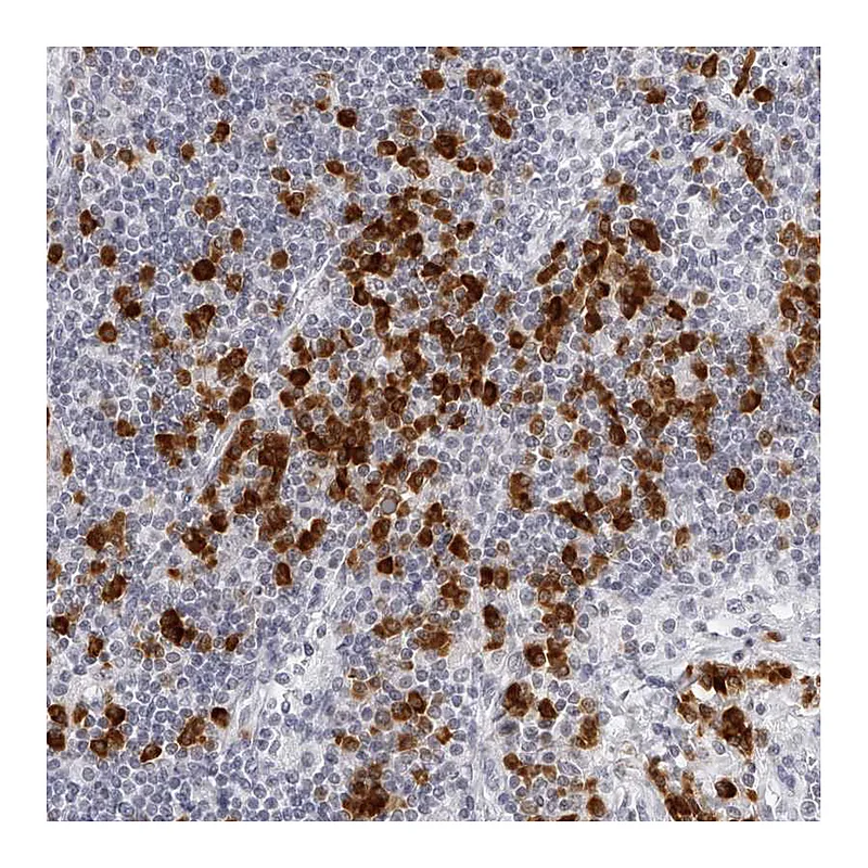 Atlas Antibodies Anti-SEC11C Antibody