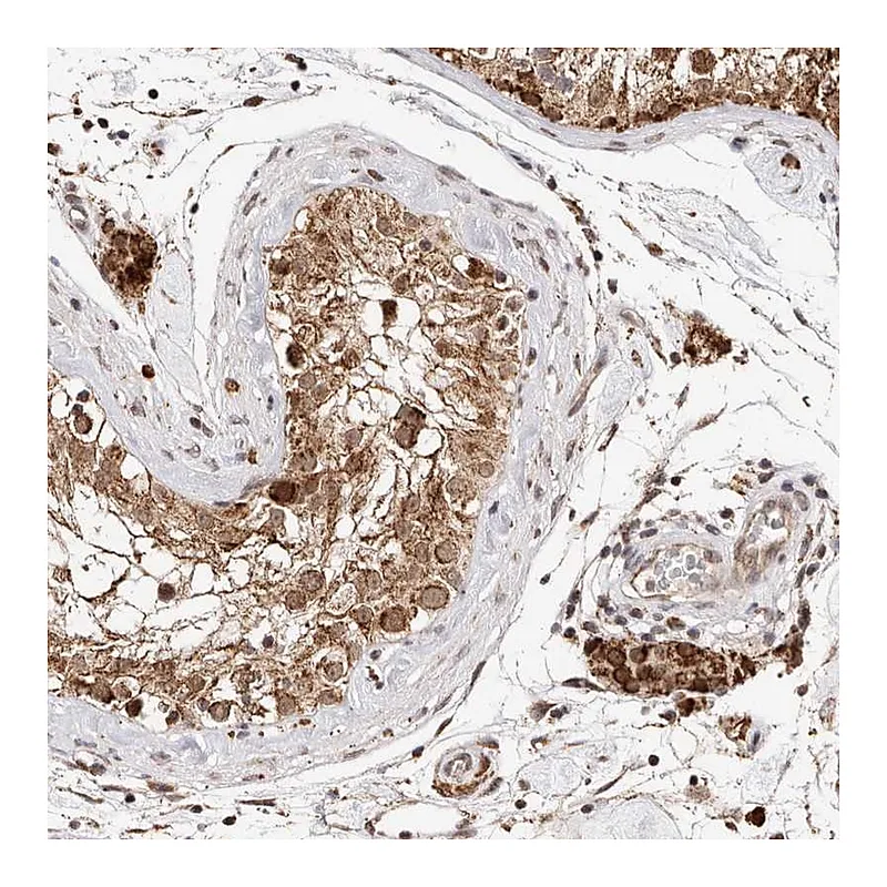 Atlas Antibodies Anti-SEC14L1 Antibody
