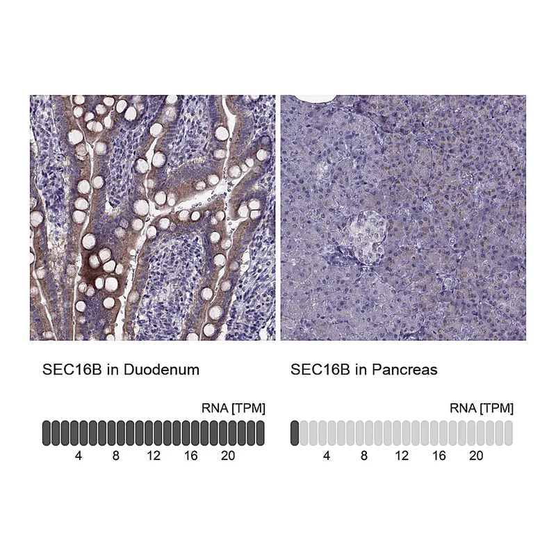 Atlas Antibodies Anti-SEC16B Antibody