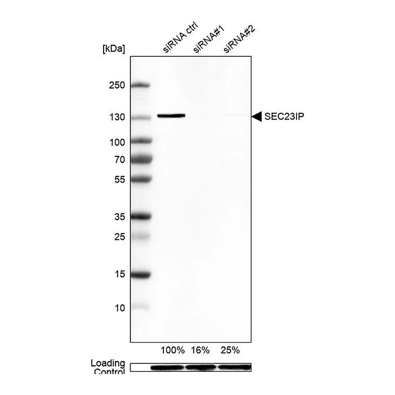 Atlas Antibodies Anti-SEC23IP Antibody