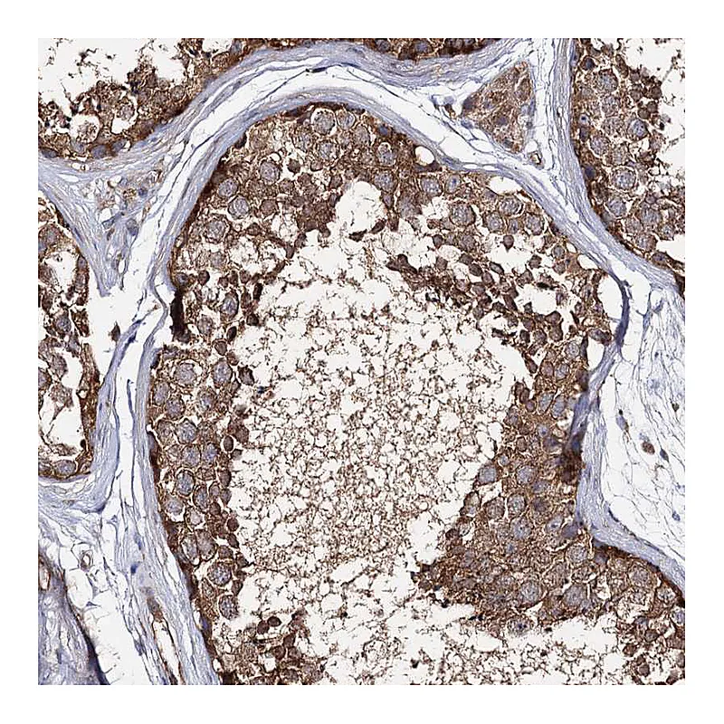 Atlas Antibodies Anti-SEC24B Antibody