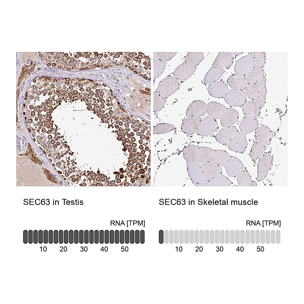 Atlas Antibodies Anti-SEC63 Antibody