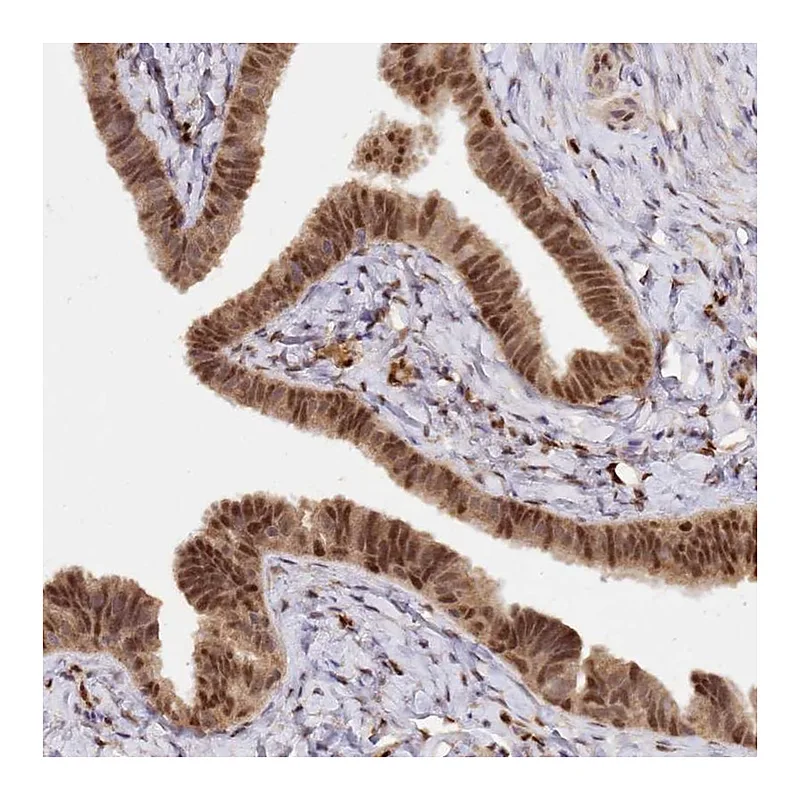 Atlas Antibodies Anti-SECISBP2 Antibody