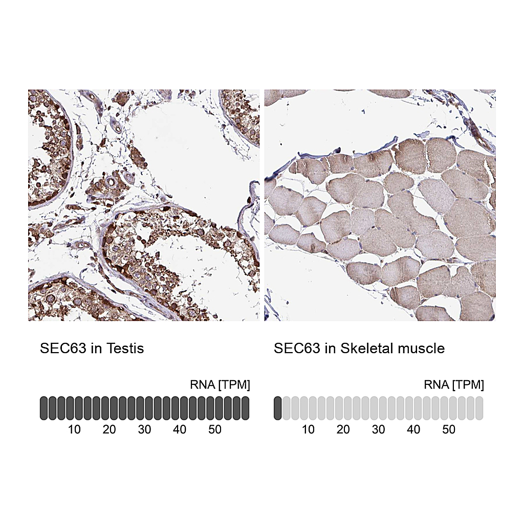 Atlas Antibodies Anti-SEC63 Antibody