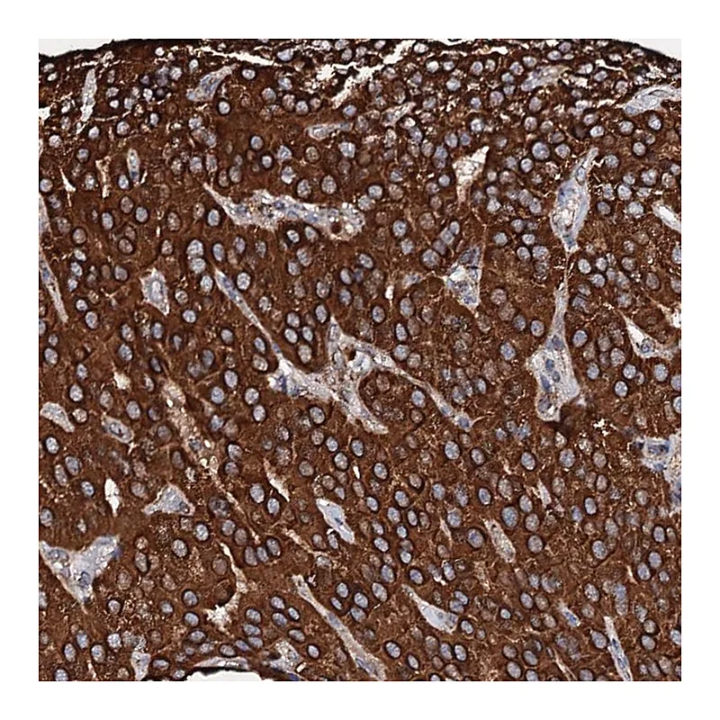 Atlas Antibodies Anti-SECISBP2L Antibody