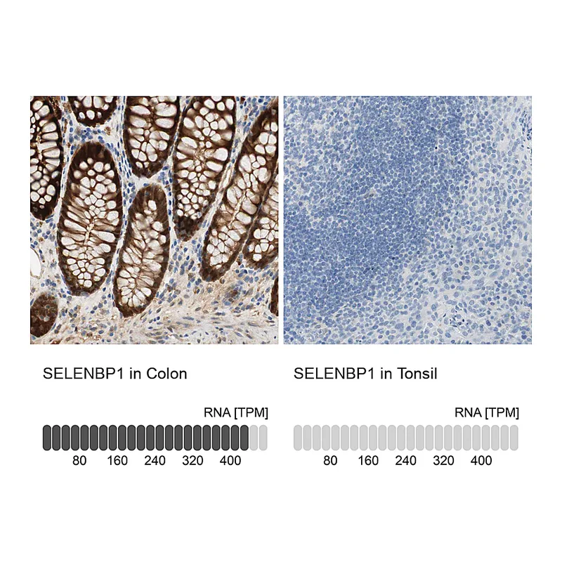 Atlas Antibodies Anti-SELENBP1 Antibody