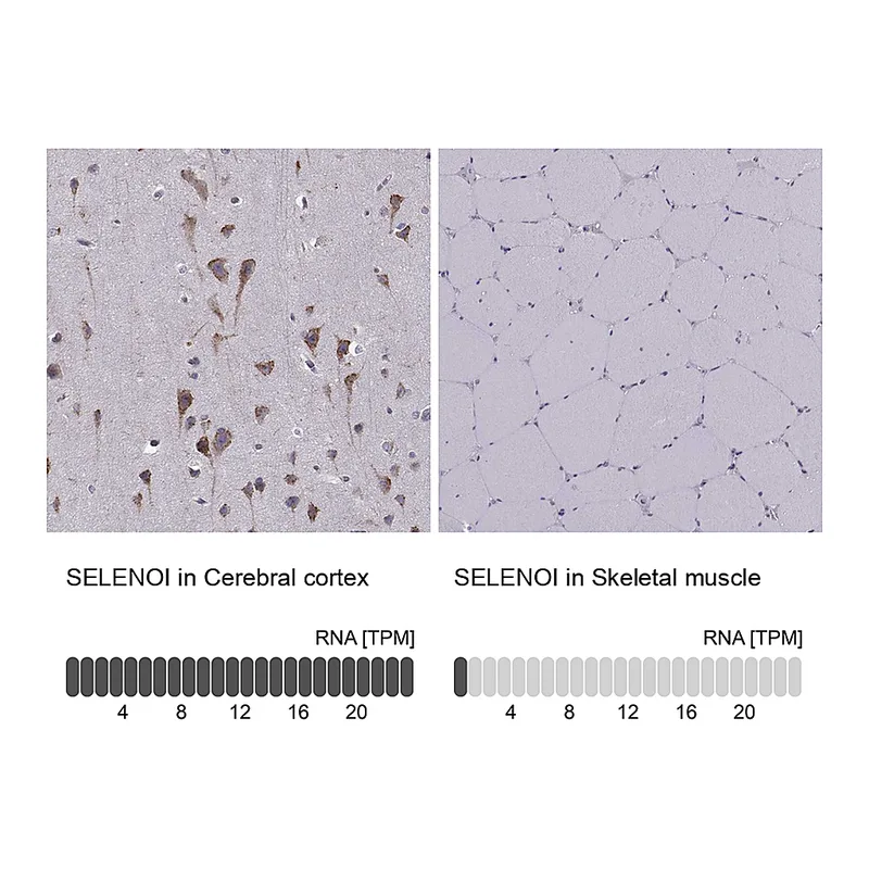 Atlas Antibodies Anti-SELENOI Antibody
