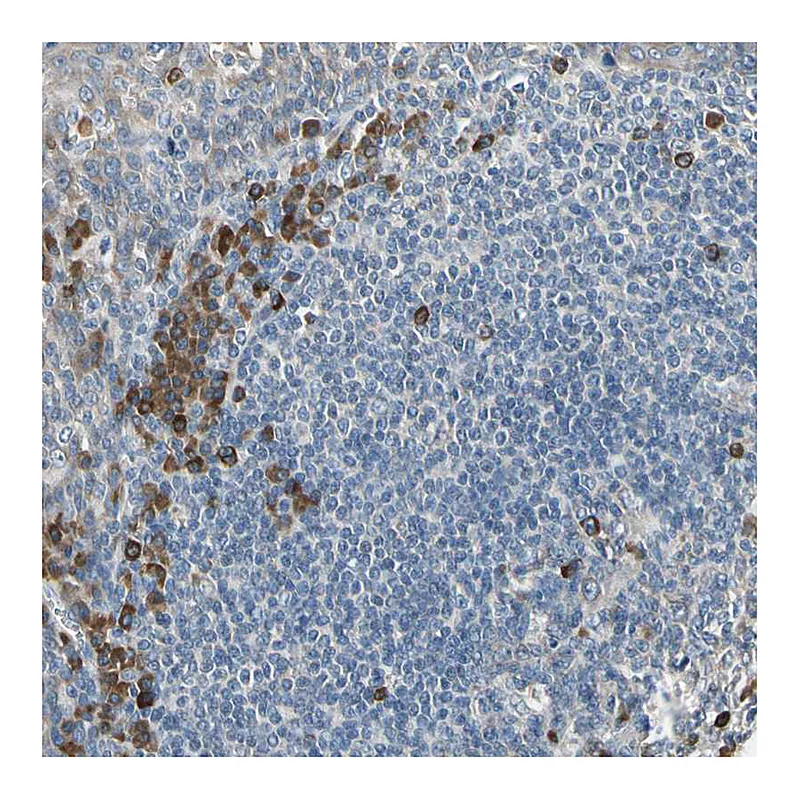 Atlas Antibodies Anti-SELENOK Antibody