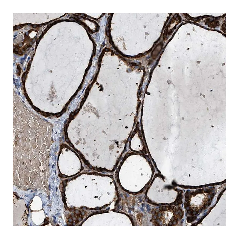 Atlas Antibodies Anti-SELENOM Antibody
