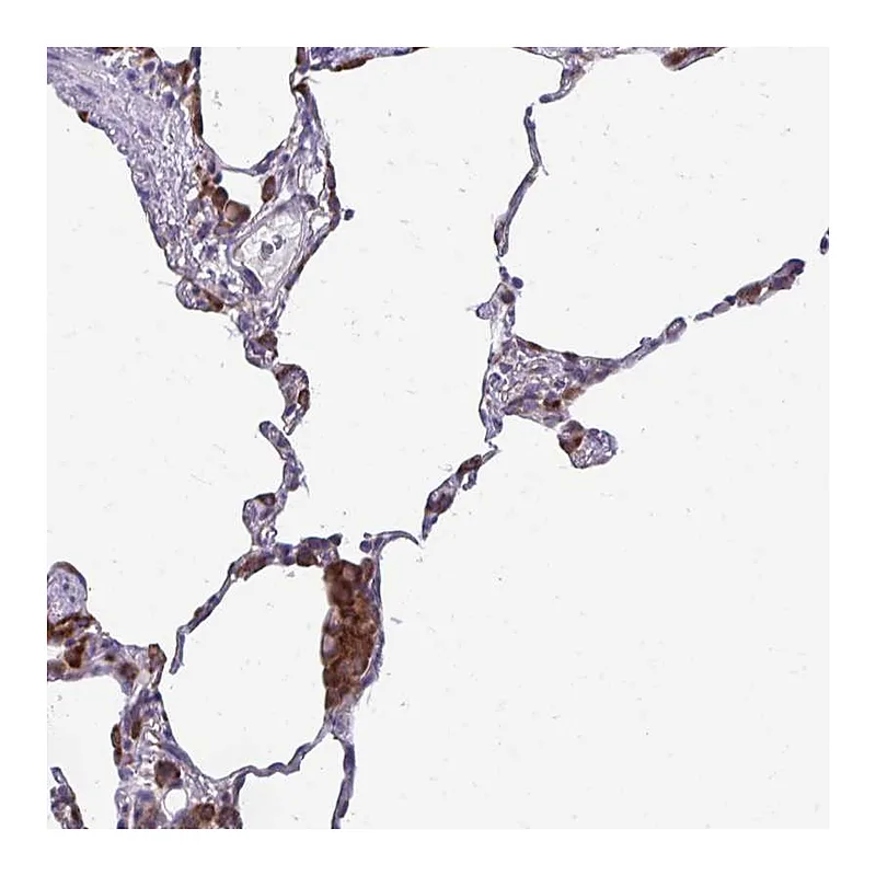 Atlas Antibodies Anti-SELENON Antibody