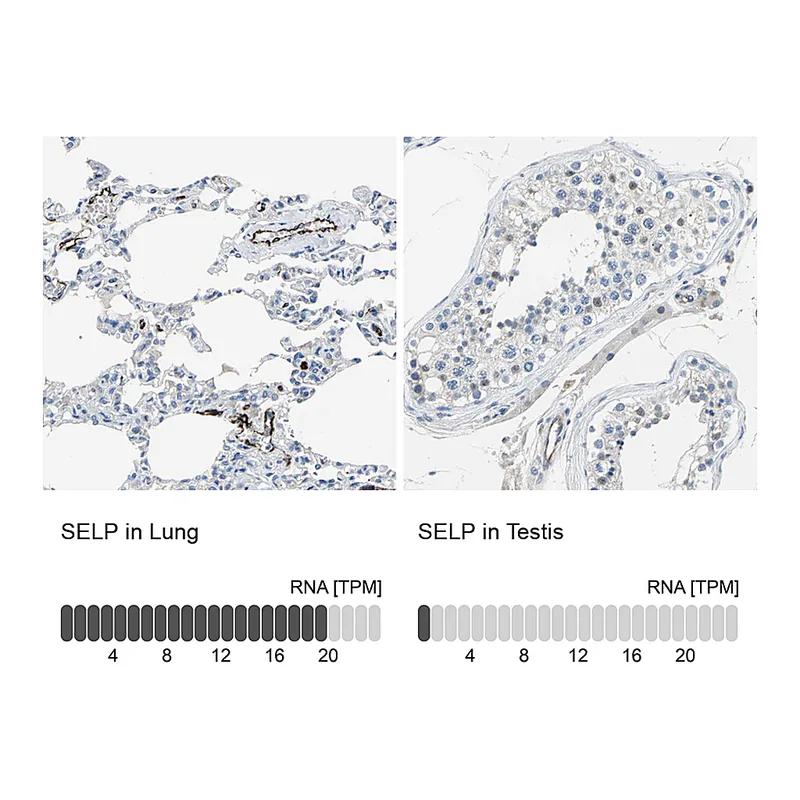 Atlas Antibodies Anti-SELP Antibody