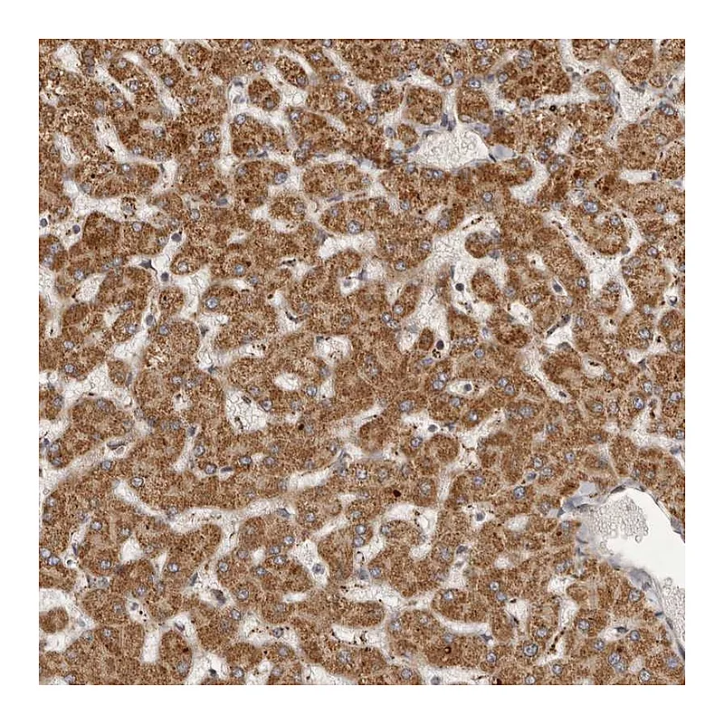Atlas Antibodies Anti-SEMA3A Antibody