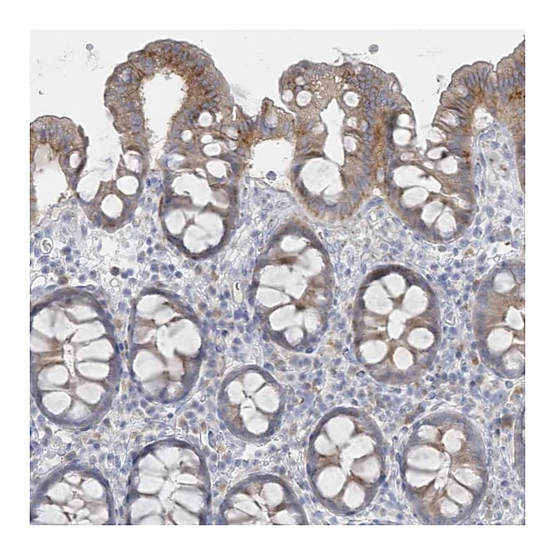 Atlas Antibodies Anti-SEMA3D Antibody