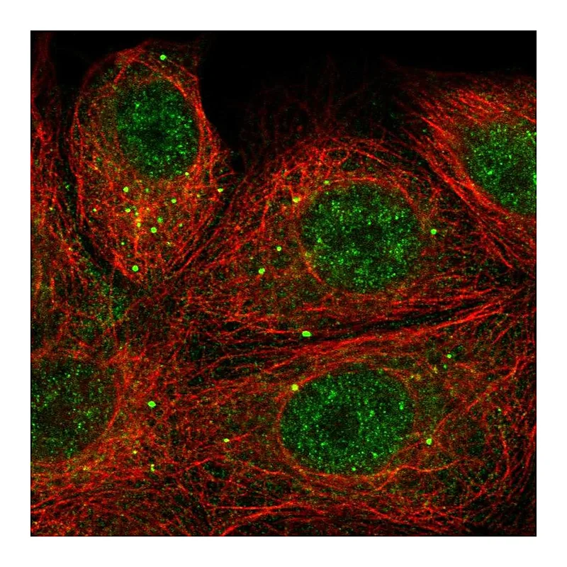 Atlas Antibodies Anti-SEMA3E Antibody