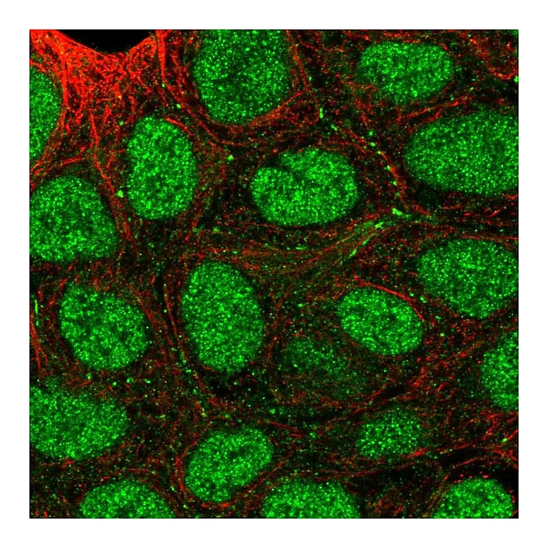 Atlas Antibodies Anti-SEMA4A Antibody