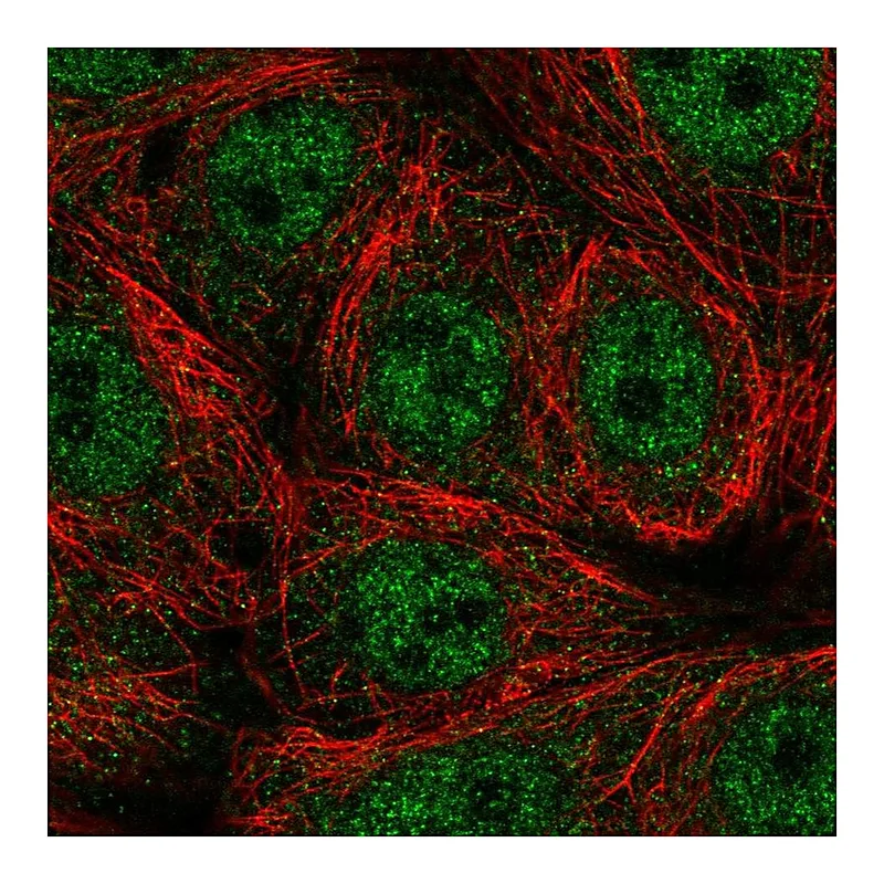 Atlas Antibodies Anti-SEMA4A Antibody