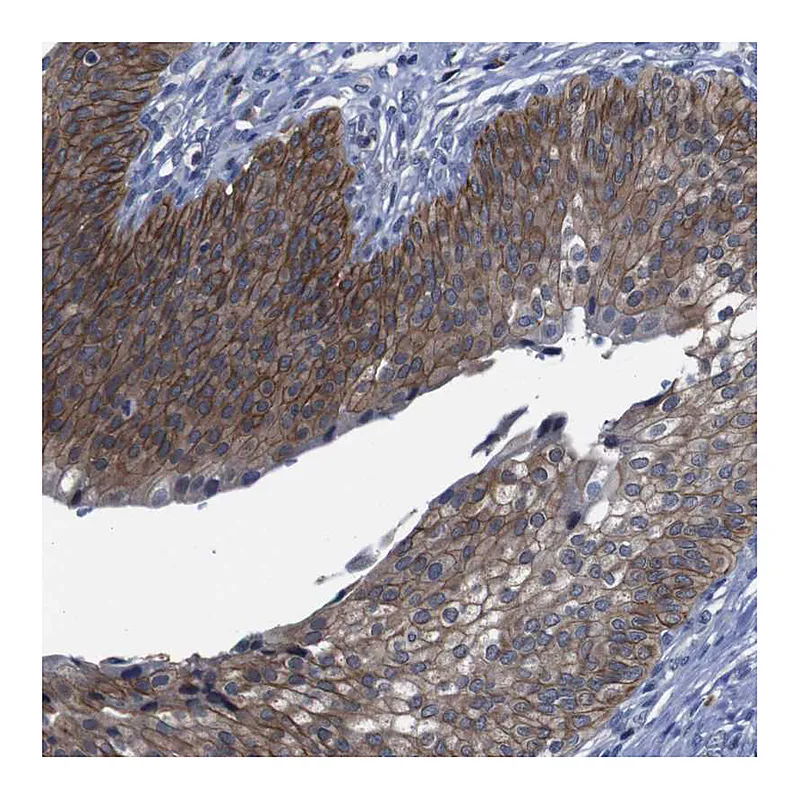 Atlas Antibodies Anti-SEMA4B Antibody