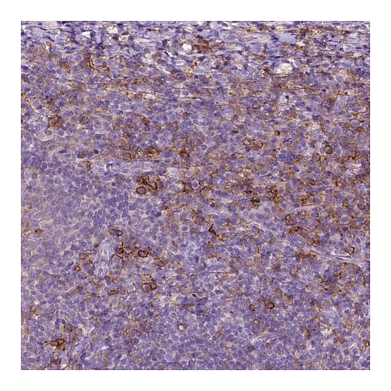 Atlas Antibodies Anti-SEMA4A Antibody