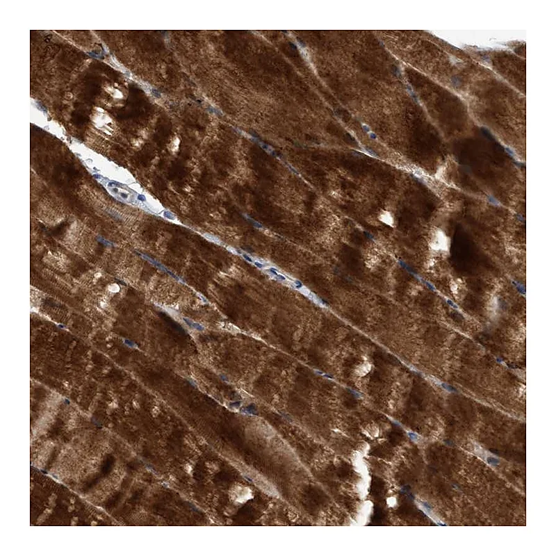 Atlas Antibodies Anti-SEMA4D Antibody
