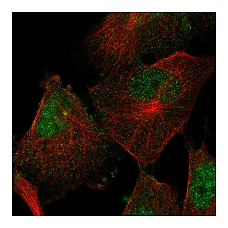 Atlas Antibodies Anti-SEMA4F Antibody