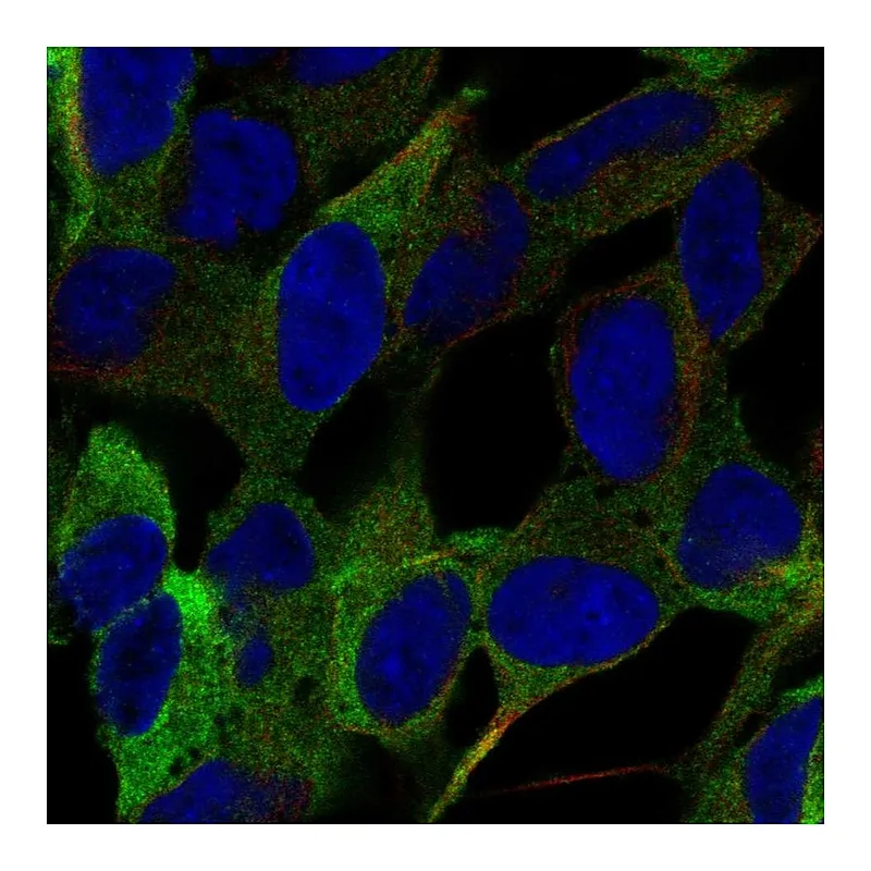 Atlas Antibodies Anti-SEMA5B Antibody