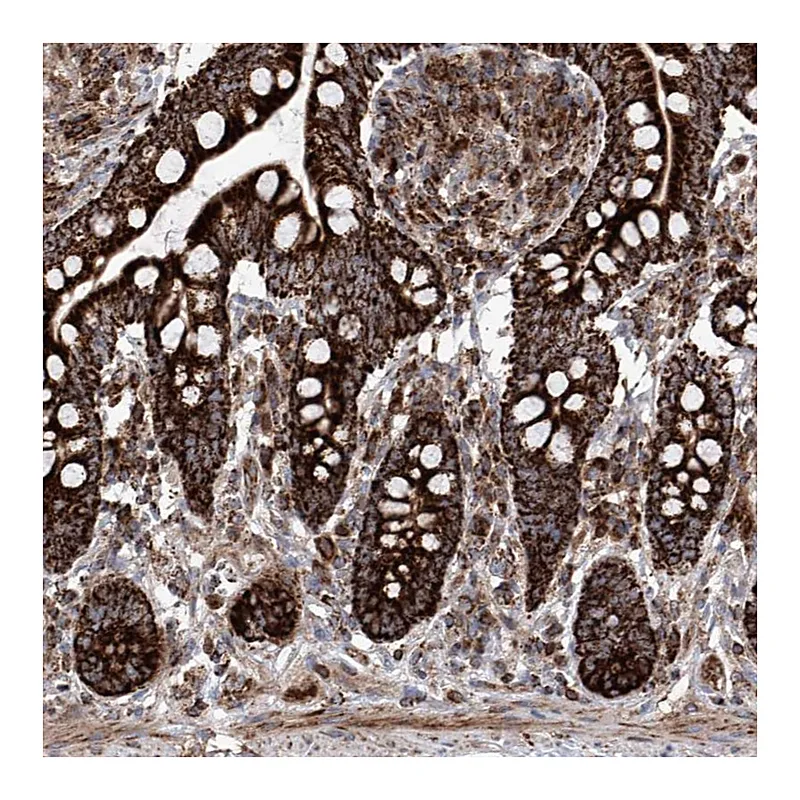 Atlas Antibodies Anti-SEMA6A Antibody