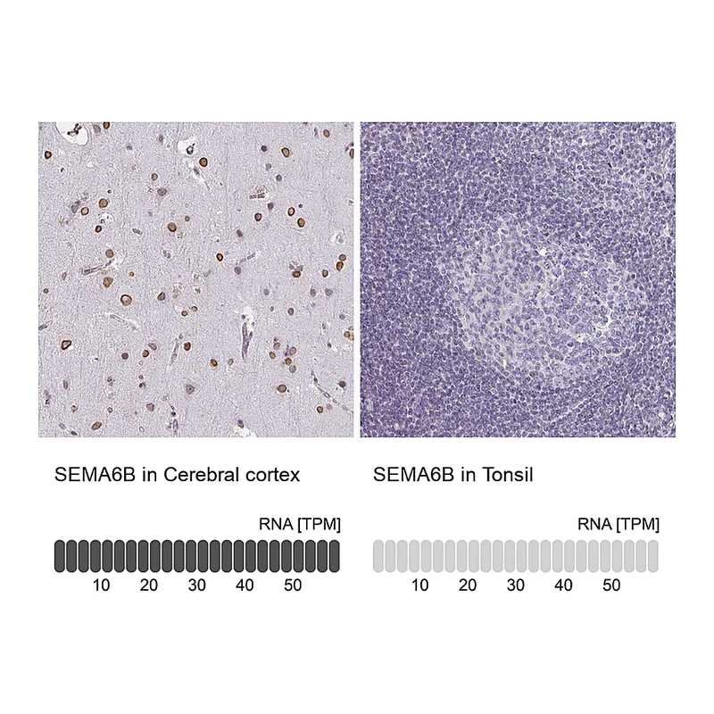 Atlas Antibodies Anti-SEMA6B Antibody