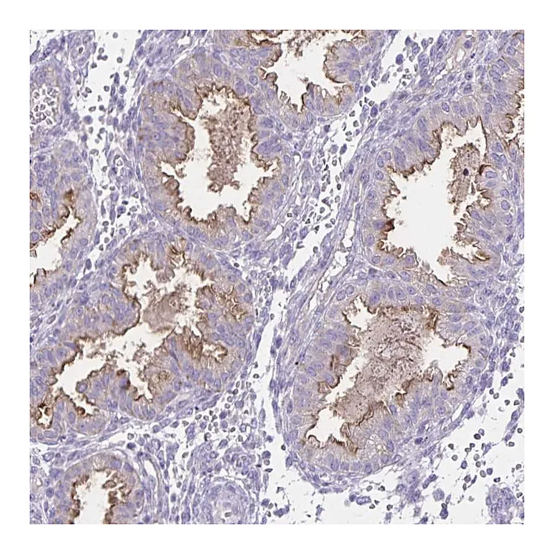 Atlas Antibodies Anti-SEMA6B Antibody