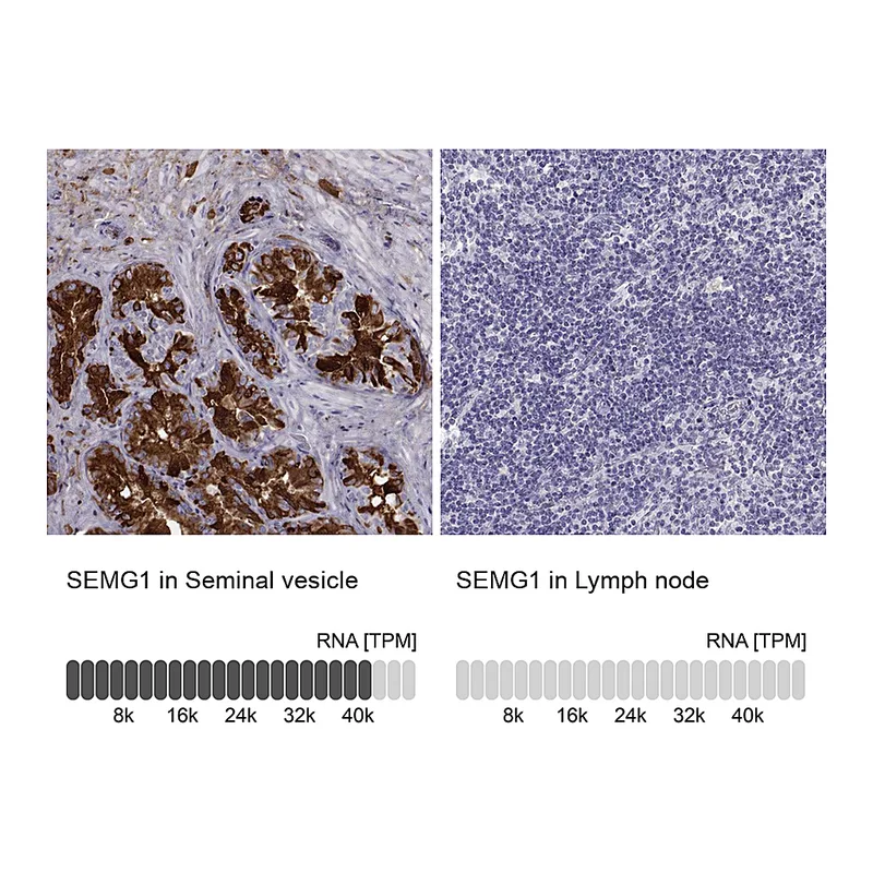 Atlas Antibodies Anti-SEMG1 Antibody
