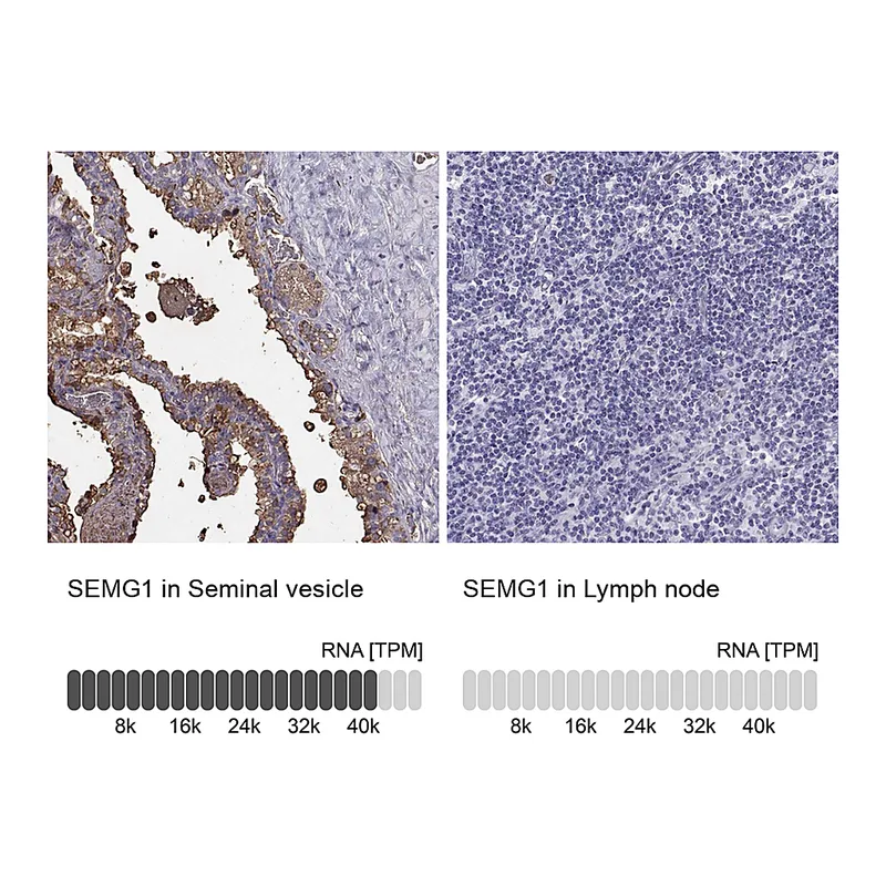 Atlas Antibodies Anti-SEMG1 Antibody