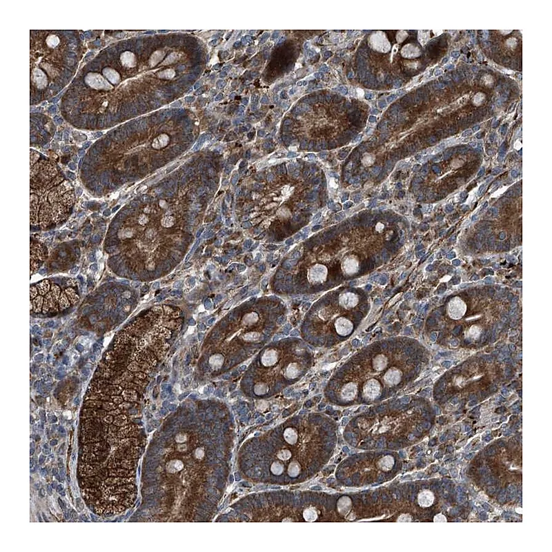 Atlas Antibodies Anti-SENP2 Antibody