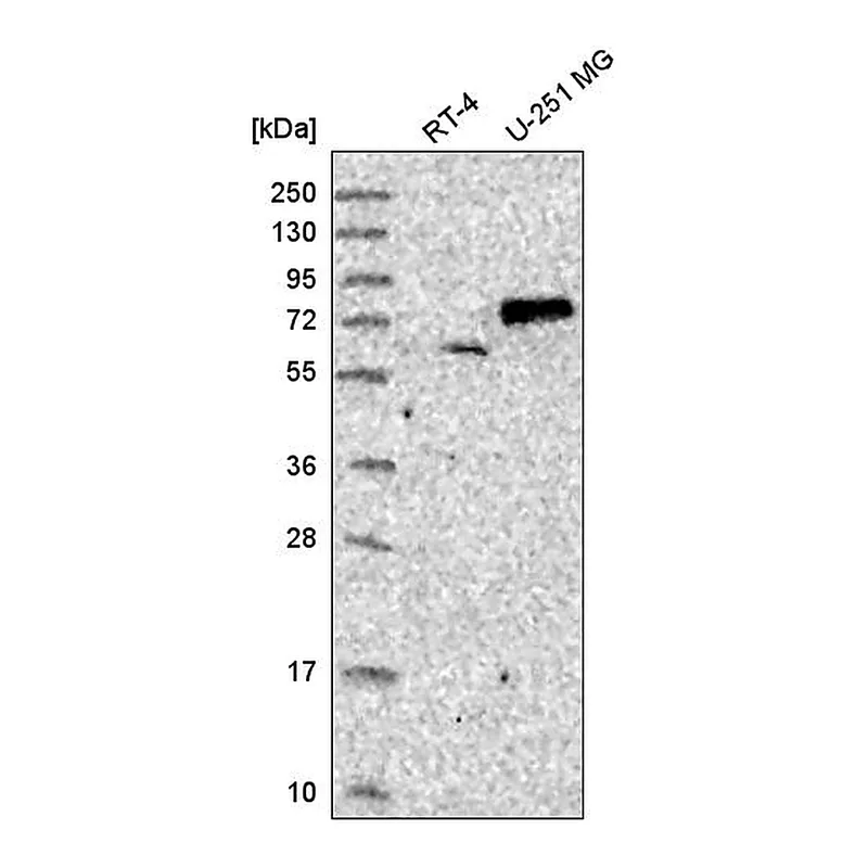 Atlas Antibodies Anti-SENP1 Antibody