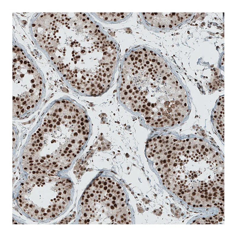 Atlas Antibodies Anti-SENP1 Antibody