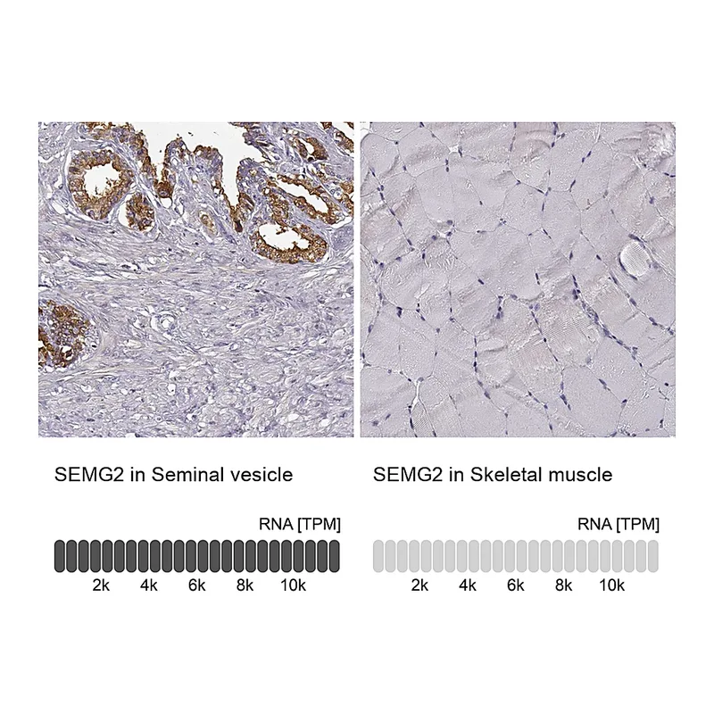 Atlas Antibodies Anti-SEMG2 Antibody