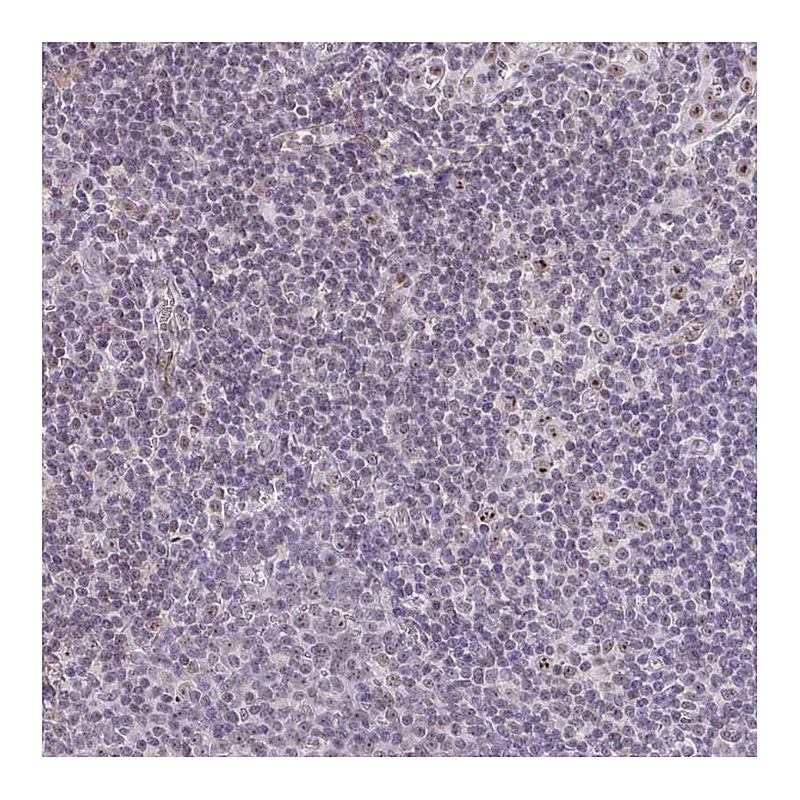Atlas Antibodies Anti-SENP3 Antibody