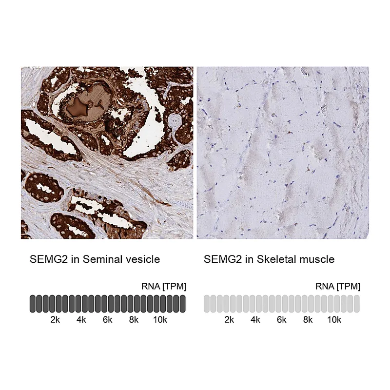 Atlas Antibodies Anti-SEMG2 Antibody