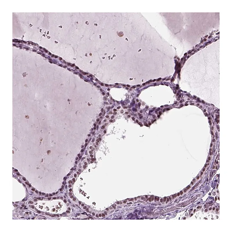 Atlas Antibodies Anti-SEPHS1 Antibody
